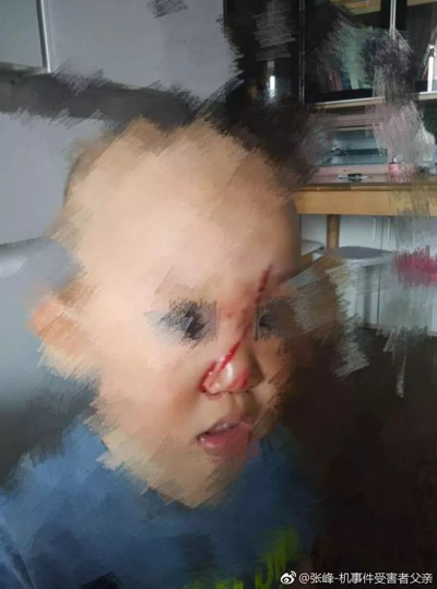 奔驰高管！在华伤人在先，拒赔在后，网友们怒了！