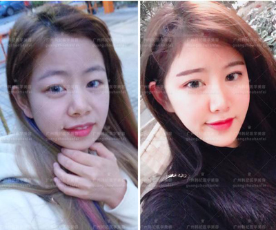 1543367975442122.jpeg 4.jpeg