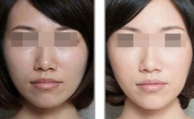 1543464039622618.png 4.png