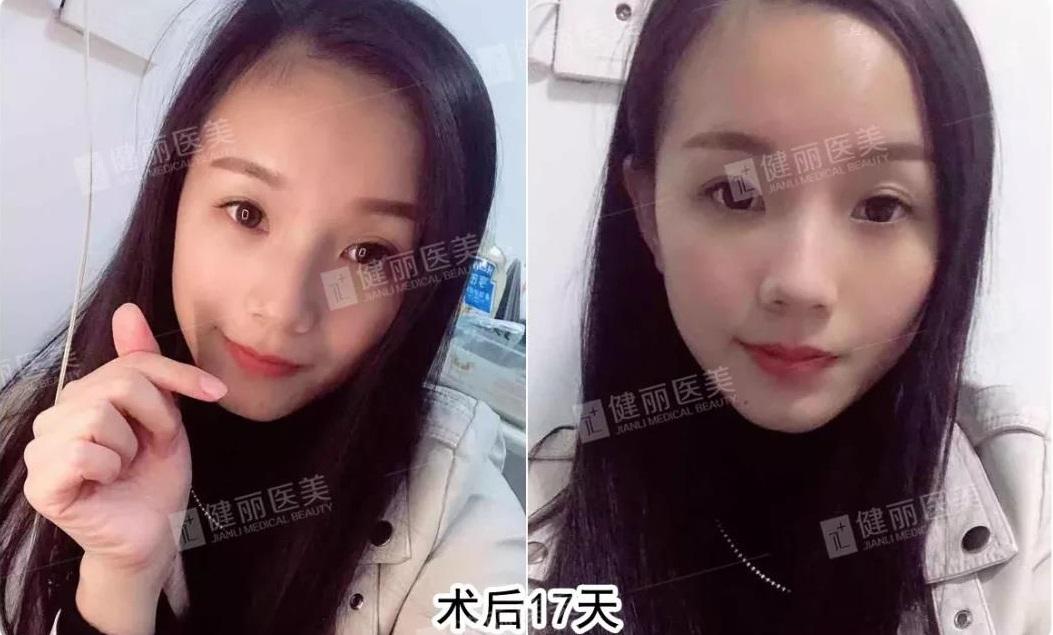 1550479985569632.jpg 1550479985569632.jpg