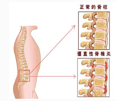 1553233927266929.jpg 5c92f3b591f70.jpg