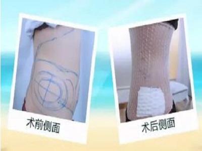 1555921368435608.jpg 5cbd780dcf0e1.jpg