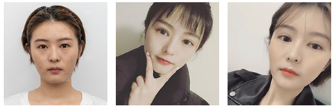 兰宇医师案例展示