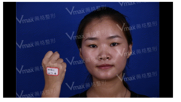 1558527190393655.png image.png